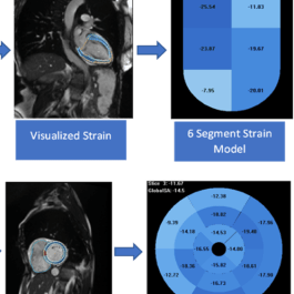 Cardiac Mechanics: Reproducible MRI Strain
