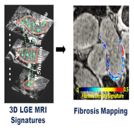 Precise Fibrosis Signatures for MRI-Guided Cardiac Diagnosis & Intervention